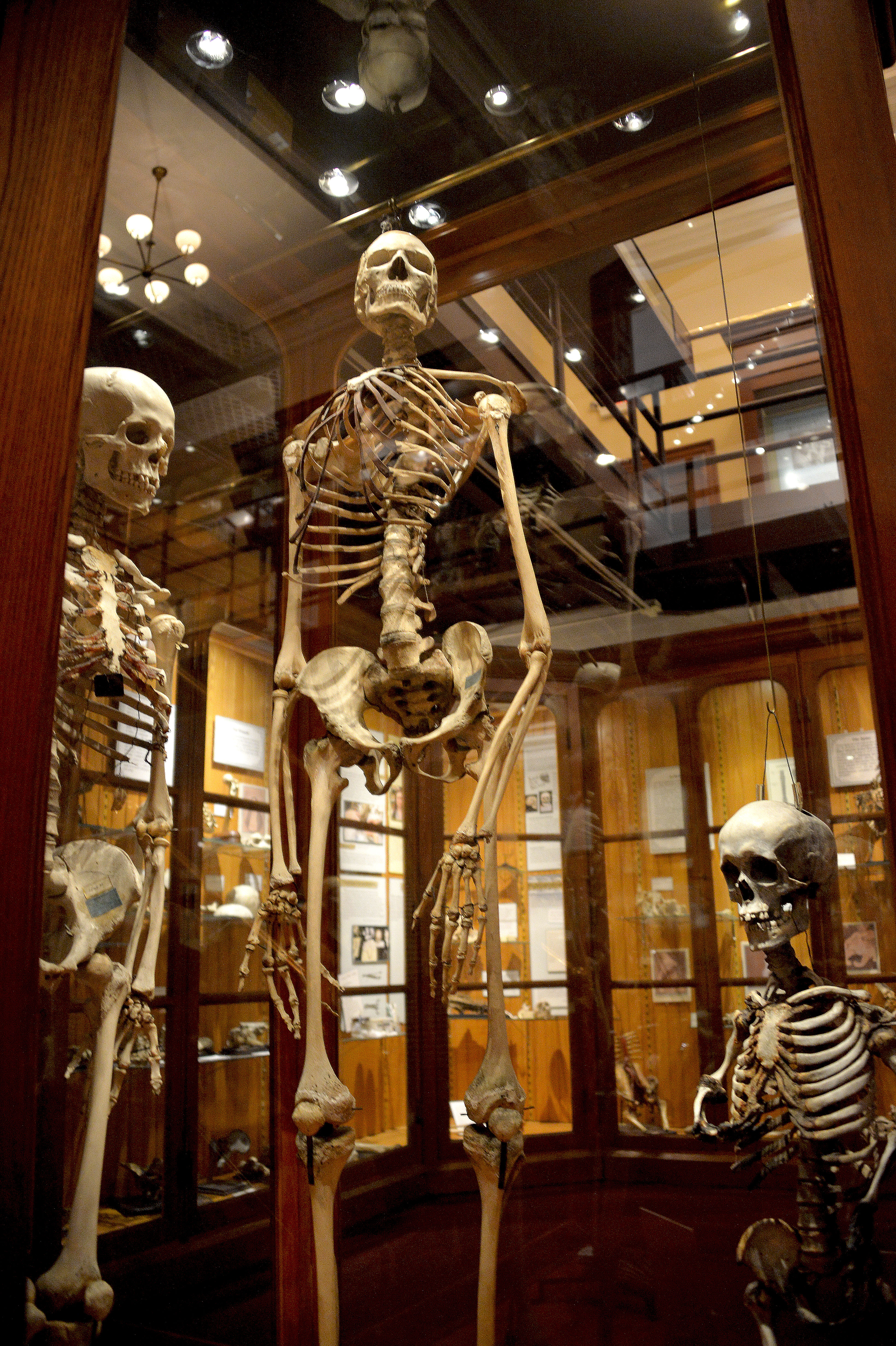 mutter-museum-s-medical-mysteries-al-d-a-news